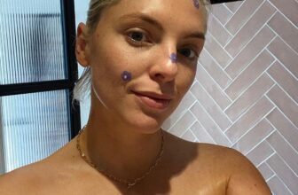 Blemish Control — Estée Lalonde